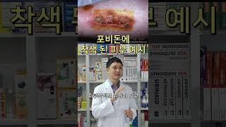 약사들이 다쳐도 빨간약, 과산화수소를 안 쓰는 이유