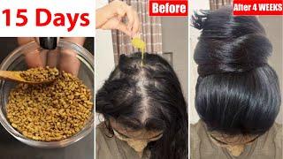 I apply just 4 Drops of this on bald scalp for 15 Days and Got Extreme Hair Growth