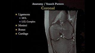 Sports Medicine Imaging Musculoskeletal Ultrasound and Ultrasound-Guided Procedures