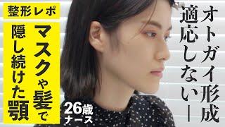 【 整形密着 】 面長で大きなアゴに悩んでいたのにドクターは"小顔"だと言う【前編】