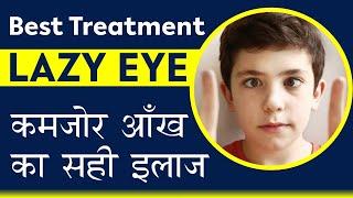 Is your child suffering from Lazy Eye & you are unaware ? कमजोर आँख का सही इलाज  Amblyopia treatment