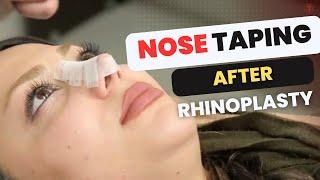 How to tape the nose after Rhinoplasty | AvaMedi 2024