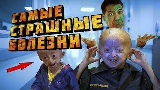 Самые страшные болезни человечества. Топ 5