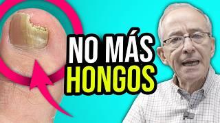  REMEDIOS PARA CURAR HONGOS En Pies Y Uñas - Oswaldo Restrepo RSC
