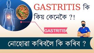 Gastritis বা গেষ্ট্ৰিকৰ সকলো কথা !! কি কিয় কেনেকৈ ??!!