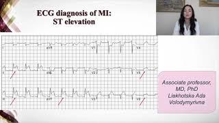 Basic symptoms and syndromes of coronary heart disease