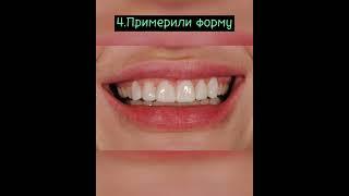 Были жалобы на сильную стираемость зубов. Лечение провели ортодонт и ортопед. На зубах виниры.