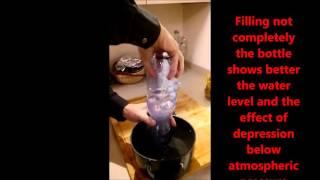 Why do the venous pressure in standing lower than expected? Author: Claude Franceschi