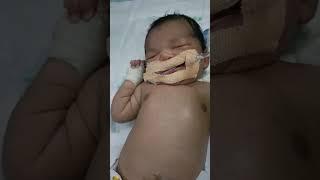 NICU baby tube saction #motivation #video #virals #nursing work #gnm