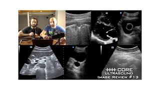 Core Ultrasound Image Review, Episode 13