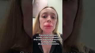 Фото с операции в тг: Фрося