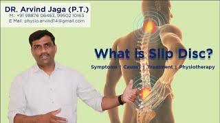 What is Slip Disc | Treatment for Slip Disc