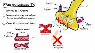 Migraines - Pathophysiology & Treatment (Described Concisely)