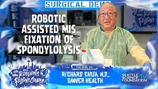 Robotic Placement of Pedicle Screws - Richard Chua, M.D.