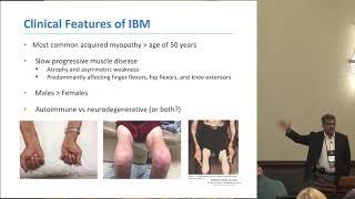 Clinical features and progression of IBM, Tahseen Mozaffar, MD