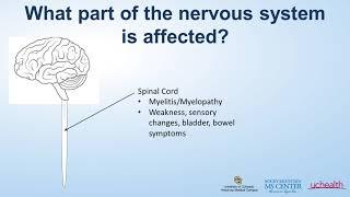 Multiple Sclerosis Webinar: The Emerging and Evolving Field of Neuroimmunology