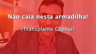 Não caia nesta Armadilha! [Transplante Capilar]