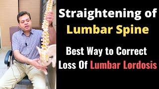 Straightening of Lumbar Spine, Loss of Lumbar Lordosis Treatment, How to Correct Lumbar Curvature