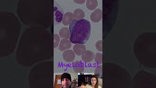 Myeloblast Morphological Characteristics