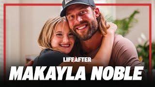 Makayla Noble on Her Life Altering Accident & Living Fully | Life After with Makayla Noble