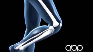 Leg Raise - 3D Medical Animation || ABP ©