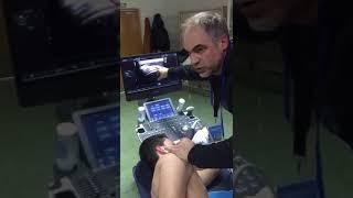 LIFESCANBURSASUBACROMIOSUBDELTOIDEA.DR SERGI BOADA