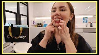 Getting fitted with Invisalign  |  Fitting appointment (Tray 1) & Surviving the Breaking-in Period