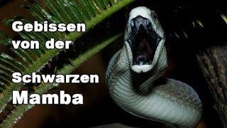 Erfahrungsbericht: Gebissen von der Schwarzen Mamba | Kurzdoku Schlangenbiss