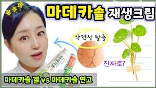 미백+보습에 좋은 마법의 재생크림 | 마데카솔연고 vs 마데카솔겔