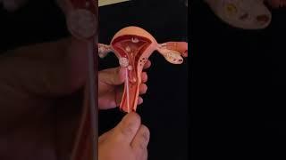 how do we get a uterine endometrial biopsy?