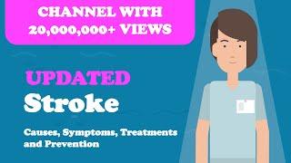 Stroke - Causes, Symptoms, Treatments & More…