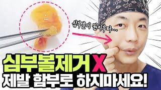 심부볼제거 입안절개 말리는 이유 |심부볼 함부로 제거 금지도대체 심부볼이 뭔데? #심부볼 완전분석/How to get rid of deep cheeks