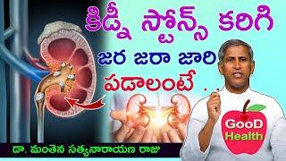 కిడ్నీ స్టోన్స్ కరిగిపోవాలంటే|Kidney Stone Treatment at Home|Manthena Satyanarayana Raju|GOOD HEALTH