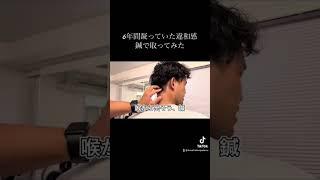 いいリアクション　#鍼治療　#首コリ #リアクション動画