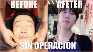 [K BEAUTY] TENGAN CARA MÁS PEQUEÑA Y BONITA EN 3 SEMANAS SIN OPERACIÓN!!