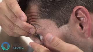 How to insert a hybrid contact lens