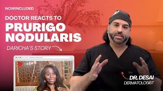 Doctor Reacts to Daricha's Prurigo Nodularis Journey