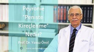 Peyronie (Penis Eğriliği) Nedir?