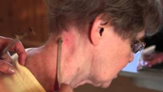 Apitherapy: Bee Stings for Your Health