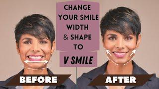 How to CHANGE Your SMILE Width and Shape to V SMILE