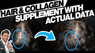 Best Collagen Drink Ever Made? Before + After, Scientific Data Analysis