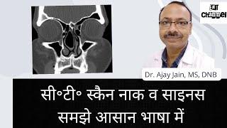 सी॰टी॰स्कैन नाक व साइनस। CT Scan of Nose & Paranasal sinuses