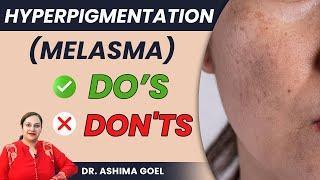 Do's And Don'ts Of Melasma | What to Avoid to Minimize Skin Damage | Dr. Ashima Goel