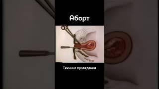 #акушергинеколог #акушерство #женскоездоровье