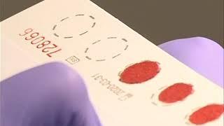 Newborn Screening Blood Spot Specimen Collection
