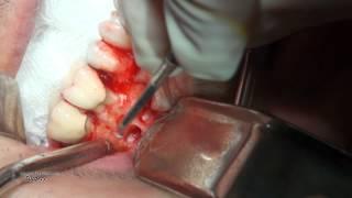 Dental Case 02 - Dr. Alexander V. Antipov