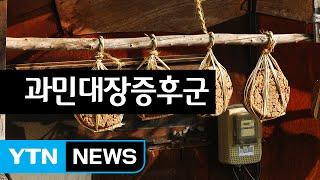 잦은 설사와 변비 '과민대장증후군' / YTN (Yes! Top News)