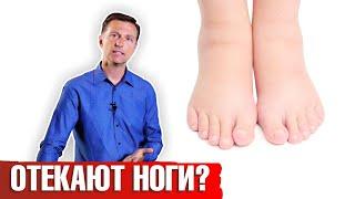 Отекают ноги: что делать? Как лечить отеки ног?