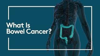 What is Bowel Cancer? | HCA Healthcare UK