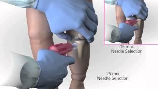 Arrow® EZ-IO® Infant Child Needle Selection and Insertion Technique Animation Video